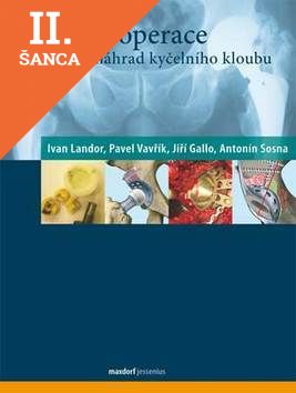 Lacná kniha Revizní operace totálních náhrad kyčelního kloubu