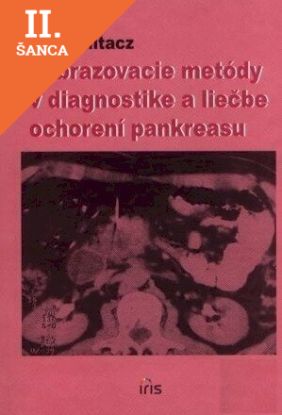 Lacná kniha Zobrazenie metódy v diagnostike a liečbe ochorení pankreasu