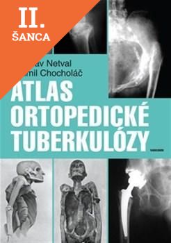 Lacná kniha Atlas ortopedické tuberkulózy