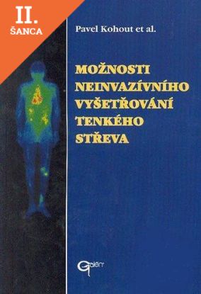 Lacná kniha Možnosti neivaznívního vyšetřování tenkého střeva