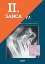 Lacná kniha Psoriatická artridida a psoriáza