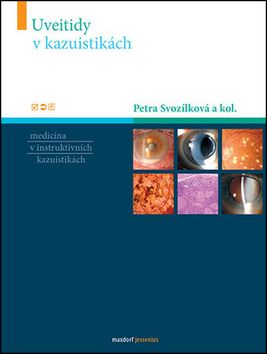 Uveitidy v kazuistikách