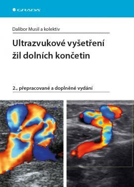 Ultrazvukové vyšetření žil dolních končetin 2. přepracované a doplněné vydání