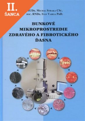 Lacná kniha Bunkové mikroprostredie zdravého a fibrotického ďasna