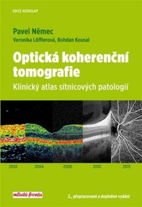 Optická koherenční tomografie