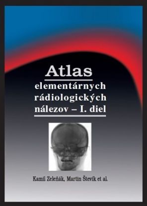 Atlas elementárnych rádiologických nálezov - I. diel