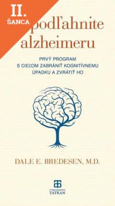 Lacná kniha Nepodľahnite alzheimeru