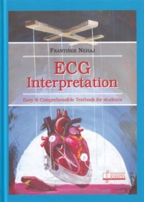 ECG - Interpretation