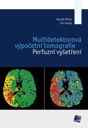 Multidetektorová výpočetní tomografie
