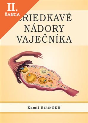 Lacná kniha Zriedkavé nádory vaječníka