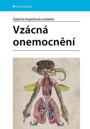 Vzácná onemocnění