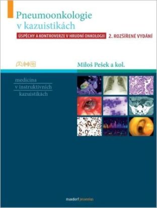 Pneumoonkologie v kazuistikách, 2.vydání
