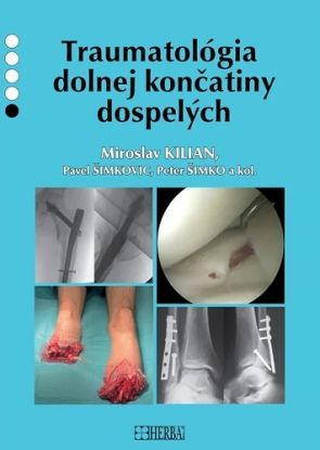 Traumatológia dolnej končatiny dospelých