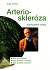 Arterioskleróza Vyhnutelné riziko